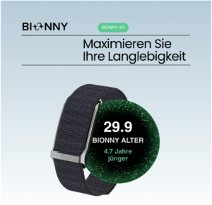 Bionny Company 2026: Wie ein 159€-Wearable ohne Abo den 60-Milliarden-Markt herausfordert — und was das für Unternehmen bedeutet